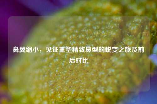 鼻翼缩小，见证重塑精致鼻型的蜕变之旅及前后对比